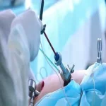 جراحی‌های درمانی زنان به روش باز و لاپاراسکوپی