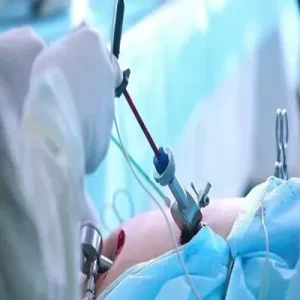 جراحی‌های درمانی زنان به روش باز و لاپاراسکوپی