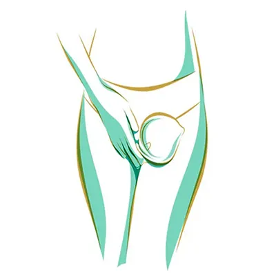 لبیاپلاستی